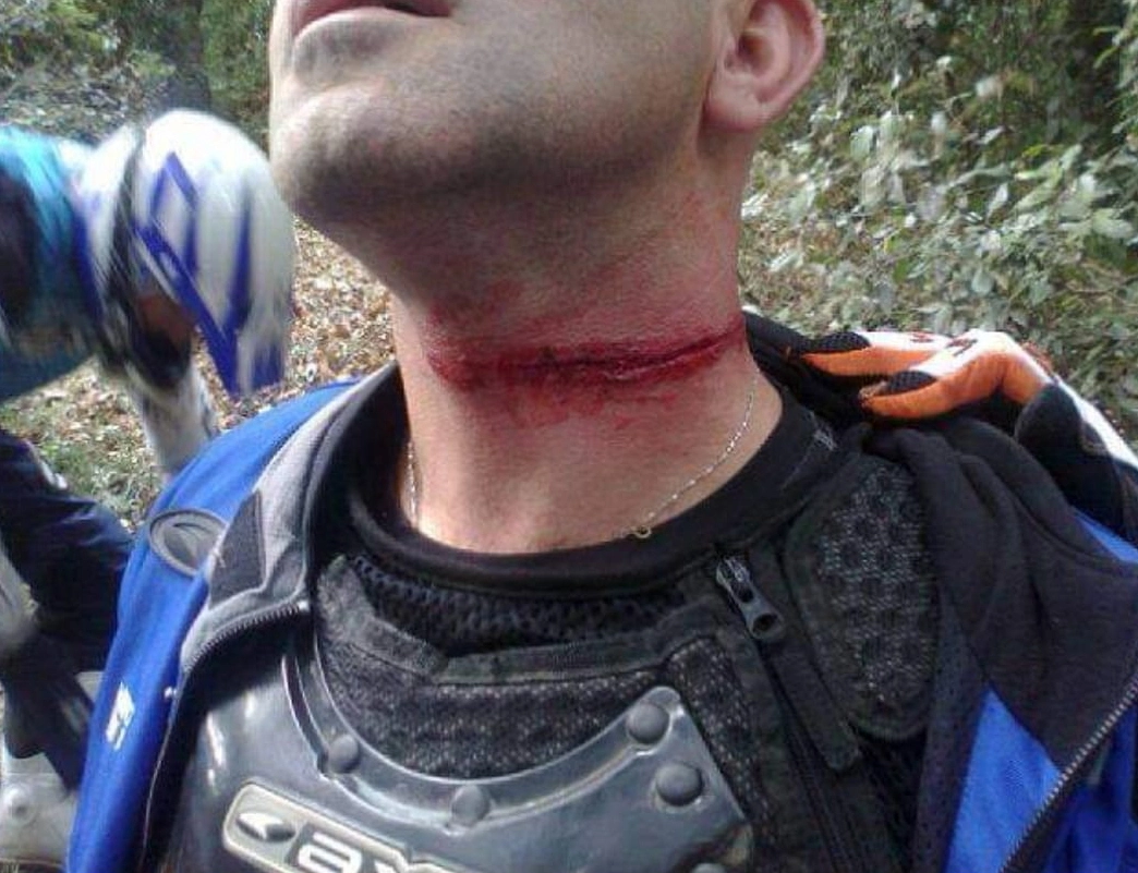 collo tagliato Zona Enduro NECKGUARD FORKSAVER – Because Wires Shouldn’t Decide Your Ride